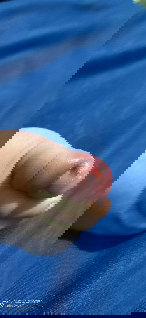 Cantengan bayin3bulan