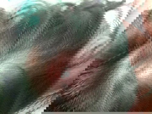 Bukol sa ulo na parang pigsa