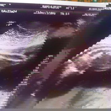 Mommy-ii tau tak gambar scan baby saya niee boy or girl ..