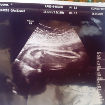 Mommy-ii tau tak gambar scan baby saya niee boy or girl ..