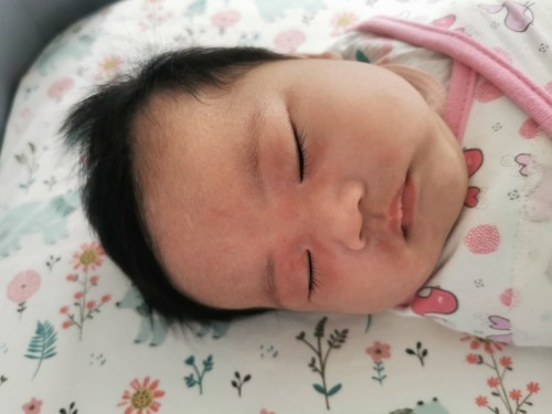 Red patches around eyes