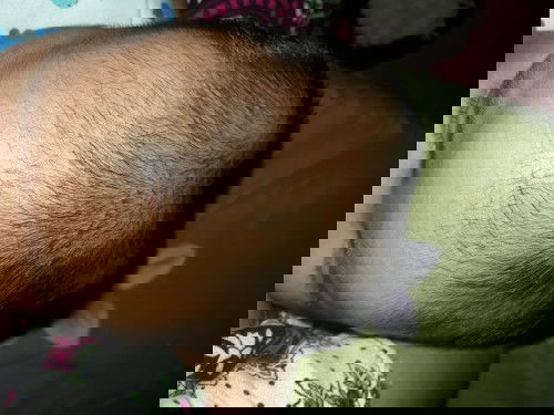 Hallo bunda" semua mau tanya nih ,kepala bayi saya begini normal ga yah ,usia nya baru 1bln 19hari,