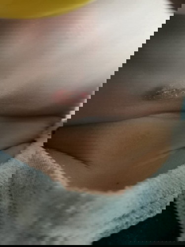 Red spot that look like bruise