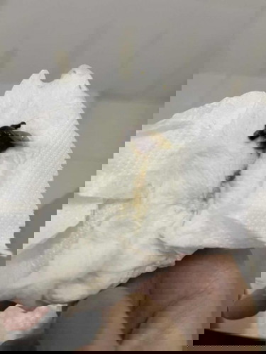 35+5 Week อันตรายมั้ยคะ