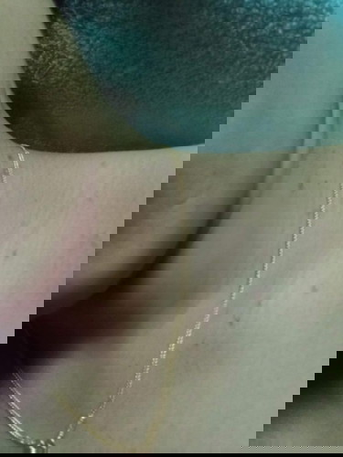 แม่ๆค่ะท้องได้32+3มีตุ่มขึ้นที่คอแบบนี้เปนเพราะเราท้องด้วยรึเปล่าค่ะ 
ทำไงถึงจะหายค่ะ