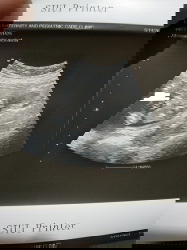 hello po mga moms🥰 want ko po sana ipahula sa inyo kung anong gender ni baby.katuwaan lang din po😘