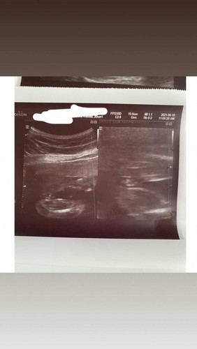 Baby girl??? Pa confirm naman po.