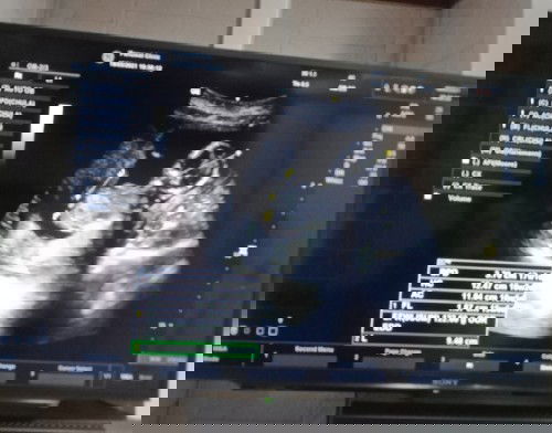 #4พฤศจิกา🤱🏻