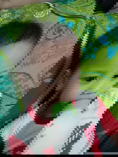 Mata merah + belekan