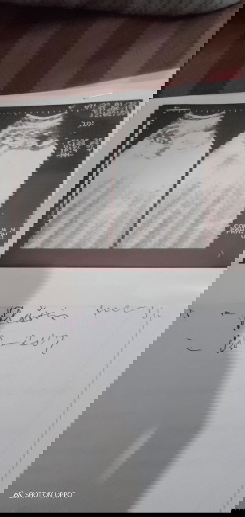 (11 Jun 21) karna BPJS 😞