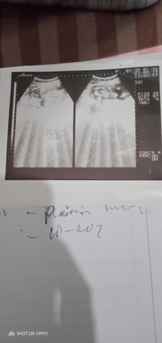 (11 Jun 21) karna BPJS 😞