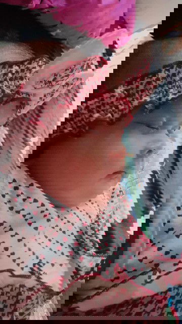 Flek wajah apa tanda lahir ?