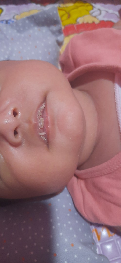 Bibir pecah²