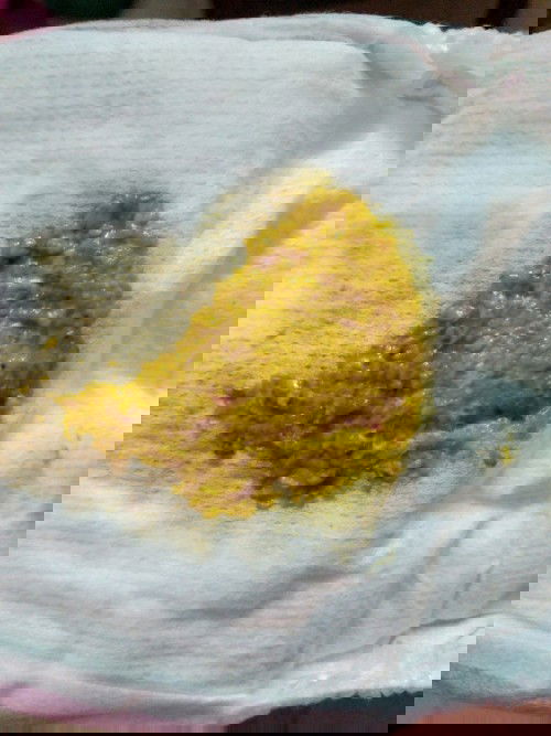 Trẻ sơ sinh rối loạn tiêu hóa