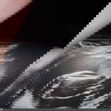 21 weeks po ako nagpaultrasound Jan pero dipa sure kung boy sya