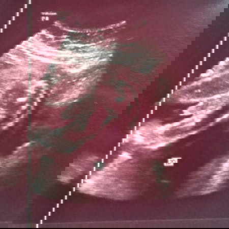 kalau tgk gambar scan ni jantina baby apa ye