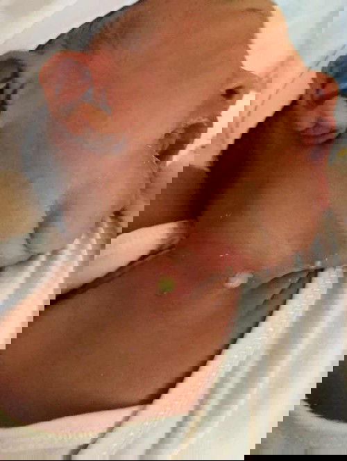 Hello po ano po kaya itong natubo sa baby ko 3days old plng po baby ko my ganito po tumubo pti sa my kili kili nya