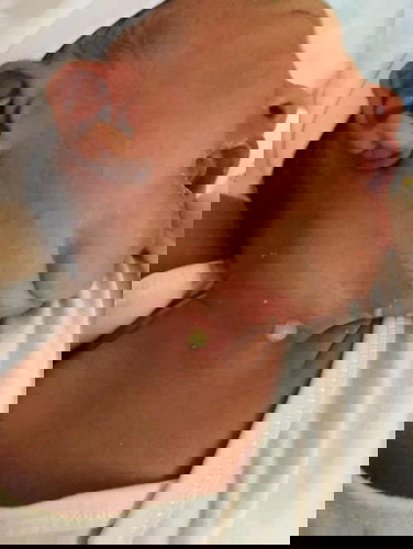 Hello po ano po kaya itong natubo sa baby ko 3days old plng po baby ko my ganito po tumubo pti sa my kili kili nya