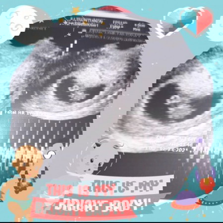 Coffee in first trimester