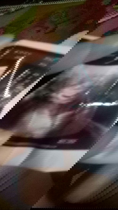 Kantung 6minggu setelah plek usg kata dokter kantung nya lonjong tidak bulat lgi 😭😭😭