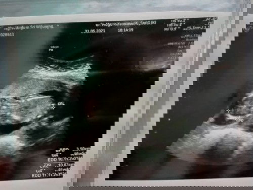 Sharing pengalaman yuk bund 🤗