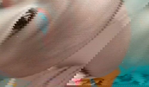 Ada bercak seperti panu