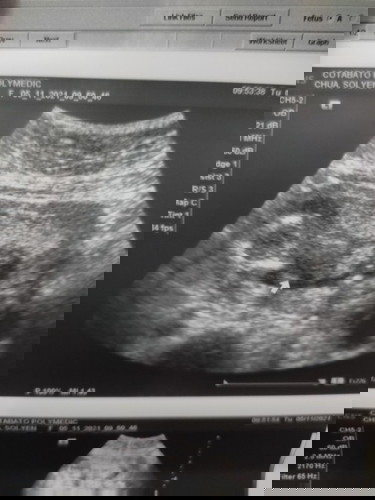 hoping for a baby girl