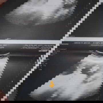 Baby boy or baby girl?