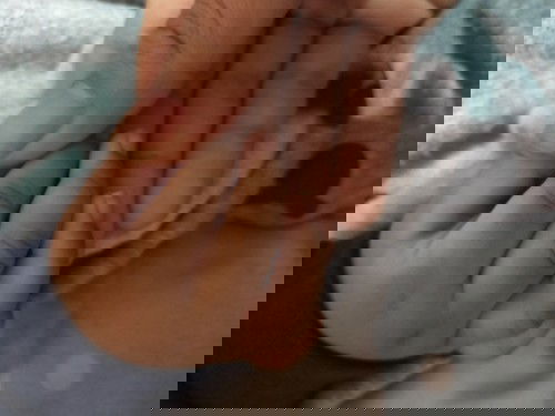 Kulit bayi menghitam dan belang