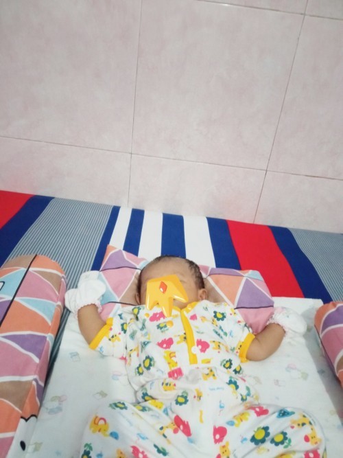 Cara mengatasi kepala peang