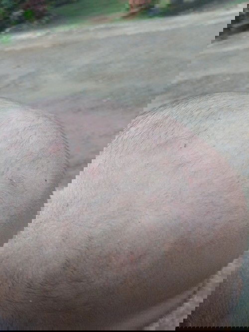 Bantu sharing dong bun