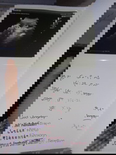 Kira kira HPL ku benar atau salah yah soalnya sudah lewat tapi belum lahiran