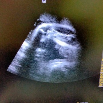 Due data hampir dekat