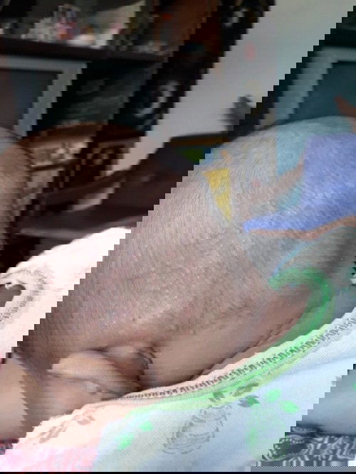 Biang keringat atau bukan