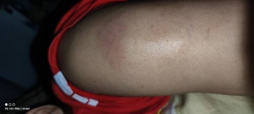 Cucuk mengandung dos pertama