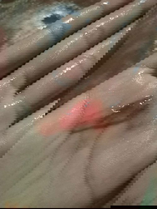 40wมีมูกเลือดออกอันตรายไหมคะ