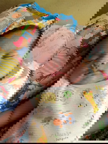 Cara ngilangin biang keringet pake apa