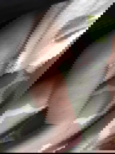 ลูกมีผื่นขึ้นขากับท้องลักษณะนี้ สาเหตุเกิดจากอะไรคะ ใครพอมีประสบการบ้างไหม ?