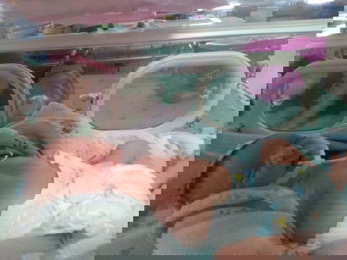 เด็กคลอดก่อนกำหนดในวันนั้น
น้ำหนักเพียง 1750 g