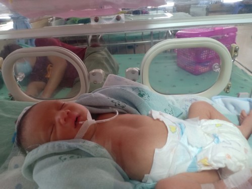 เด็กคลอดก่อนกำหนดในวันนั้น
น้ำหนักเพียง 1750 g