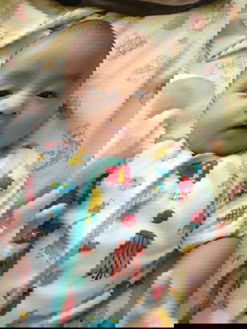 Ubun ubun bayi cembung saat demam