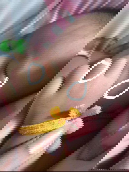 น้อง1เดือน18วันมีจุดแดงๆคล้ายผื่นแต่ไม่ใช่ ไม่มีอาการอื่นร่วมนะคะ น้องกินปกติ ร่าเริงปกติค่ะ ขึ้นที่แขนที่มือที่หน้าประมาน4-5จุดแบบนี้อันตรายไหมคะ🥺