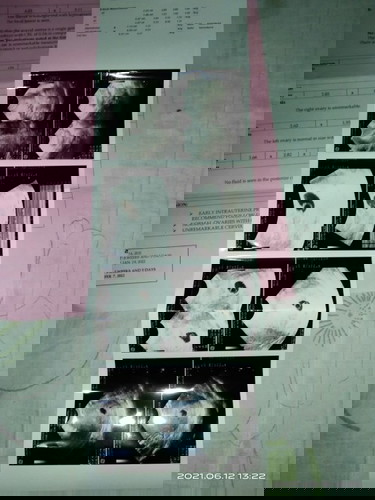 5weeks and 5days pregnant 🤰