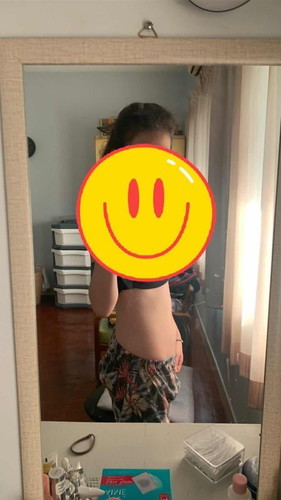 ไทรอยด์เป็นพิษระหว่างตั้งครรภ์