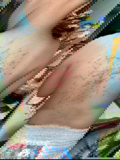 สอบถามอาการลูกคะ