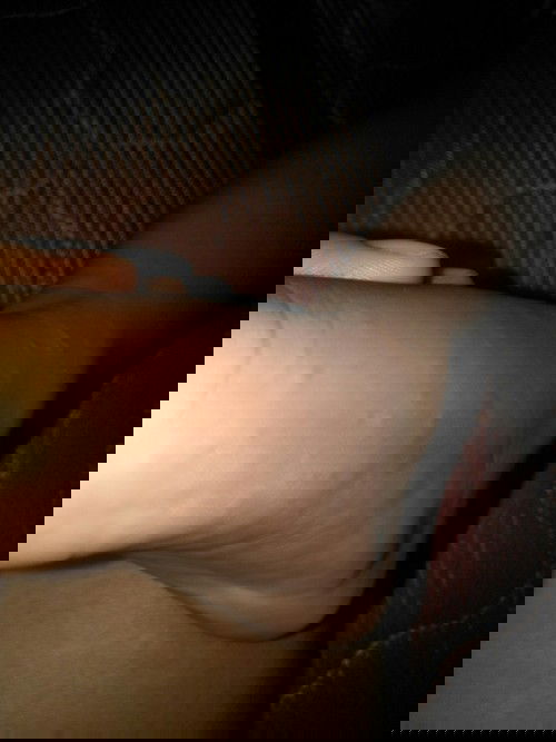 Gatal pda anak 2 tahun