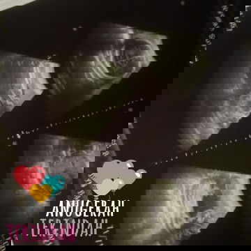 Alhamdulillah dapat baby boy😍