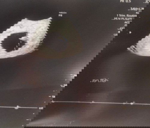 สอบถามแม่ๆค่ะ