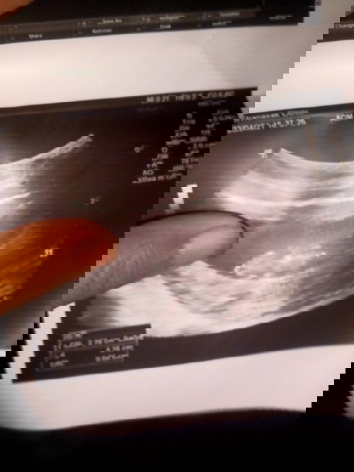 กลับมาได้รึป่าว