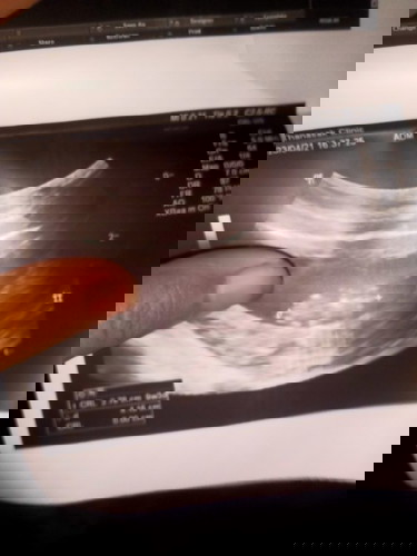 กลับมาได้รึป่าว